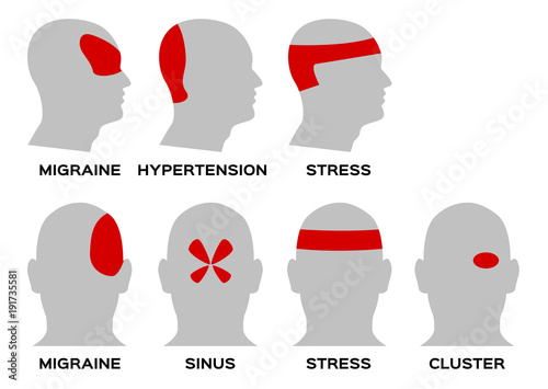 headache type vector / organ and anatomy concept