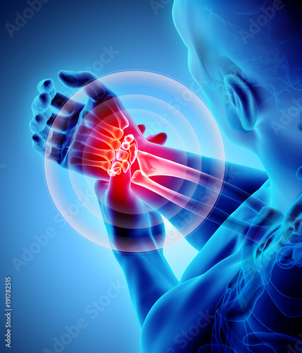Fototapeta Naklejka Na Ścianę i Meble -  Wrist painful - skeleton x-ray.
