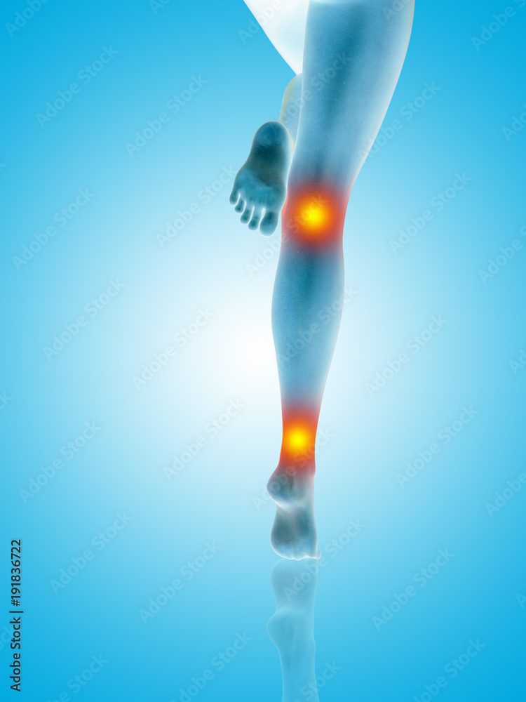 Conceptual beautiful woman or girl legs and feet with a hurt knee and ankle pain or ache. 3D illustration of human slim fit body medical health care concept, painful sport injury on blue background Conceptual beautiful woman or girl legs and feet with a hurt knee and ankle pain or ache. 3D illustration of human slim fit body medical health care concept, painful sport injury on blue background