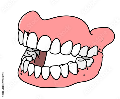 Dental Prosthesis, a hand drawn vector cartoon illustration of a prosthetic teeth.