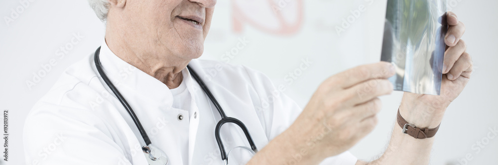 Doctor looking at x-ray scan
