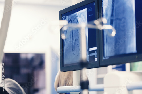 фотографія Minimally invasive cardiology transcatheter closure treatment for patent foramen