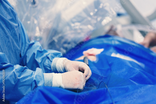 фотографія Minimally invasive transcatheter closure treatment for left atrial appendage LLA