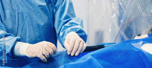 Schilderij op canvas Minimally invasive cardiology transcatheter closure treatment for patent foramen