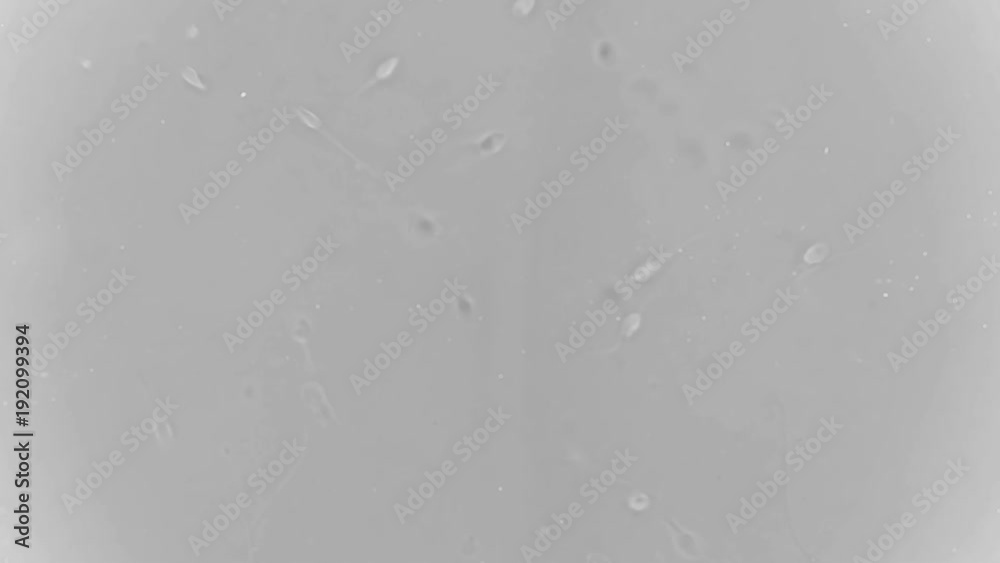 the movement of the sperm under a microscope the movement of the sperm under a microscope