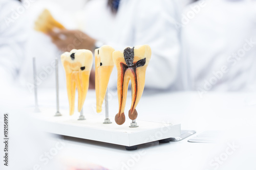 Tooth model for education in laboratory. photo