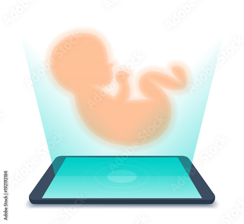 Tablet PC and hologram of human fetus above the screen. Flat vector illustration of unborn baby's ultrasound virtual image. Science, telemedicine, tele, remote medicine, pregnancy, telehealth concept.
