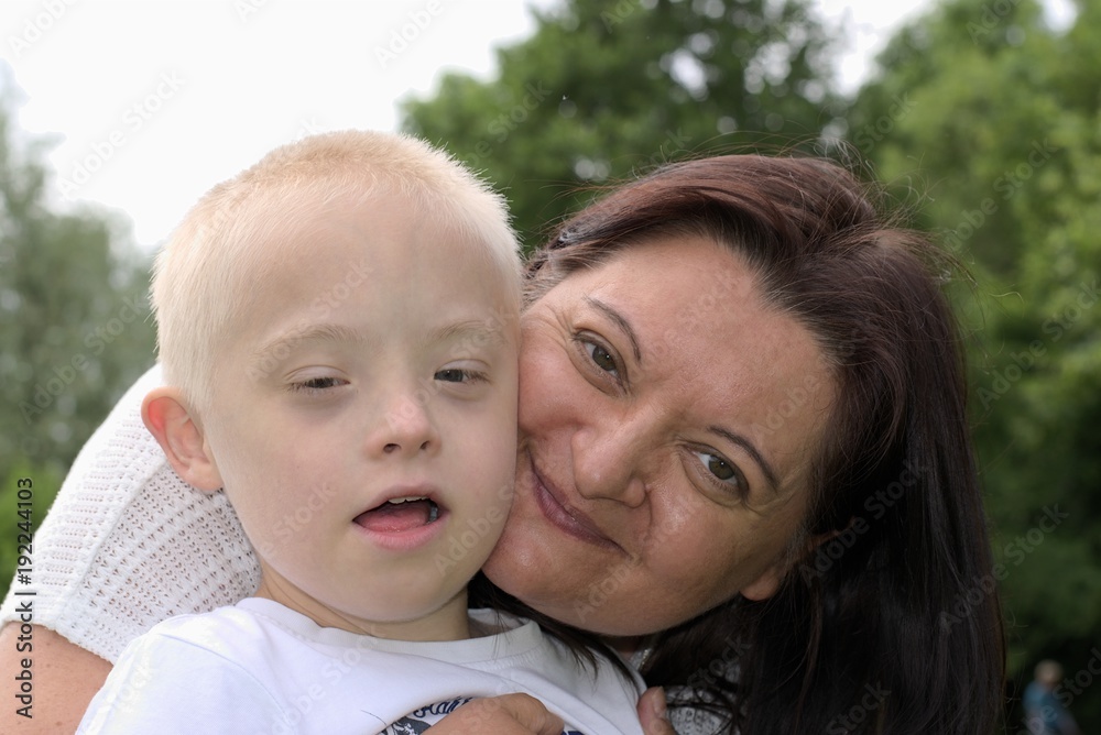 Defect,childcare,medicine and people concept- happy mother and son with down syndrome. Defect,childcare,medicine and people concept- happy mother and son with down syndrome.