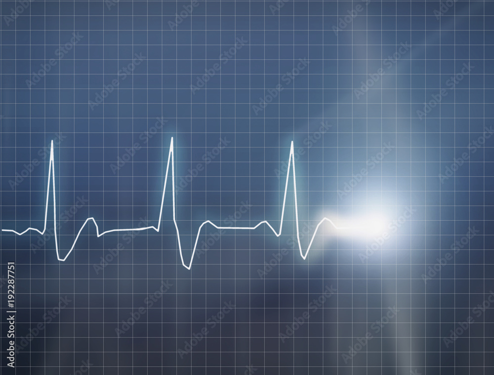 ECG ECG