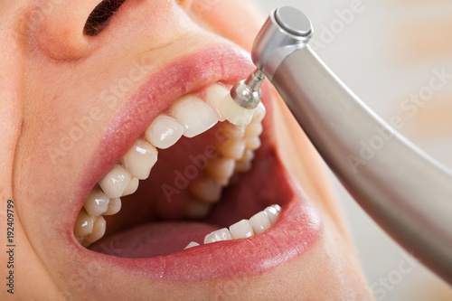 Professional dental cleaning photo