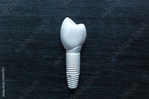 Tooth prosthesis.