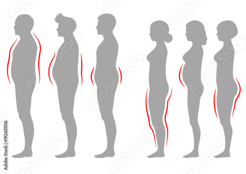 
vector illustration of obesity woman and man body type, vector figure overweight silhouette