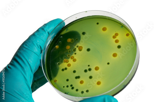 Closeup for plate Bacteria culture growth on Selective media, vibrio spp