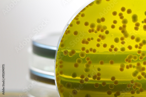 Closeup for plate Bacteria culture growth on Selective media, vibrio spp