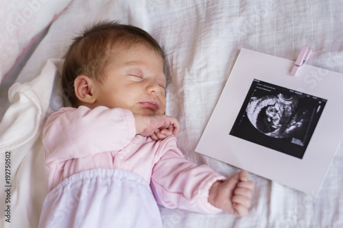 sleeping newborn baby girl  photo