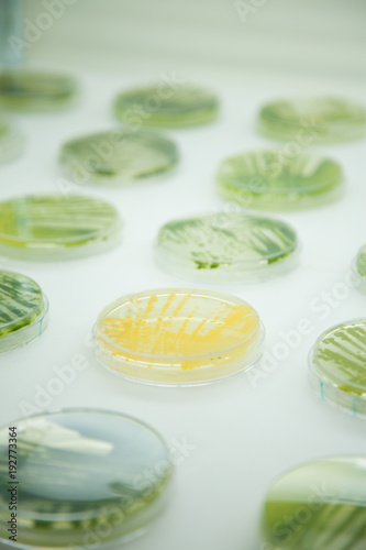 algae cultures in petri dish in a lab