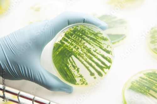 algae cultures in petri dish in a lab