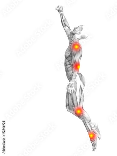 Conceptual human muscle anatomy with red and yellow hot spot inflammation or articular joint pain for health care therapy or sport concepts. 3D illustration man arthritis or bone osteoporosis disease © high_resolution