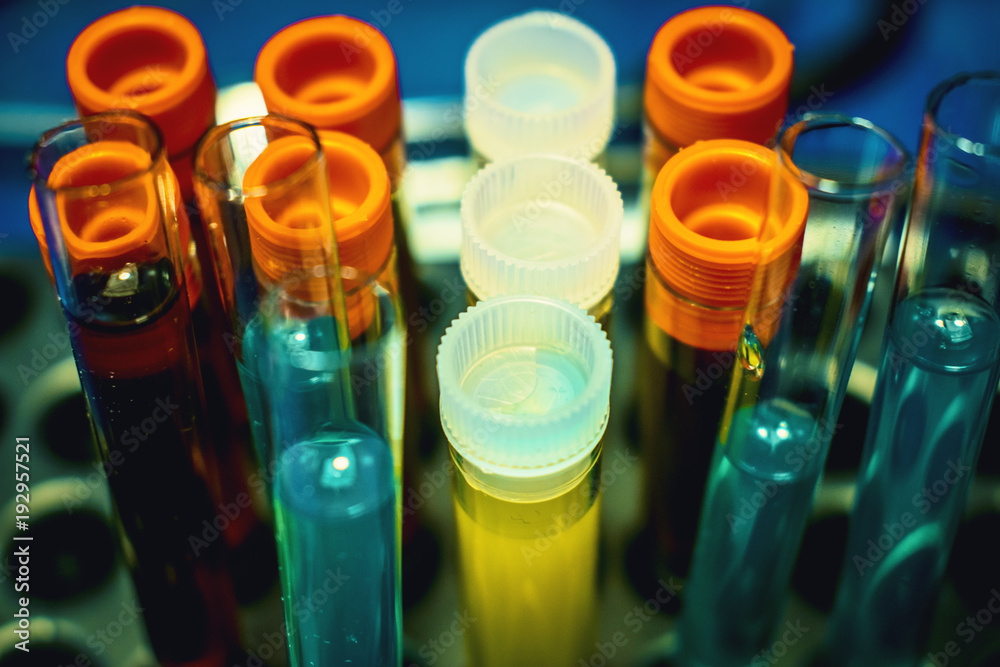 High tech lab equipment used in the in vitro fertilization process egg retrieval procedure Laboratory Fertilization Of Eggs In IVF Treatment High tech lab equipment used in the in vitro fertilization process egg retrieval procedure Laboratory Fertilization Of Eggs In IVF Treatment