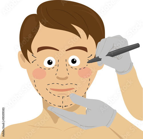Surgeon drawing marks on male face. Plastic surgery concept