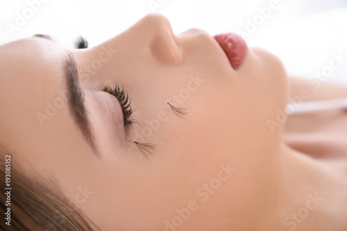 Young woman with eyelash loss problem  closeup