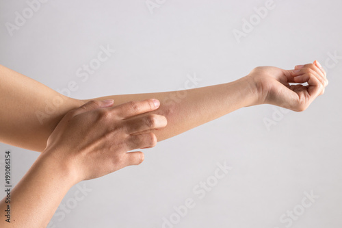 A girl scratch the itch with hand because of mosquito bites isolated on white background, Concept with healthcare and medicine.