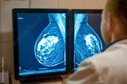 Fototapeta Doctor examines mammogram snapshot of breast of female patient on the monitors