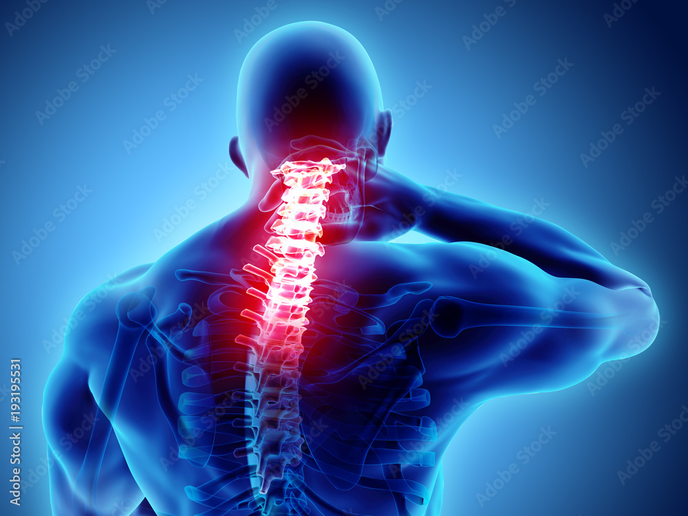 © yodiyim - 3D illustration, neck painful - cervical spine skeleton x-ray, medical concept.