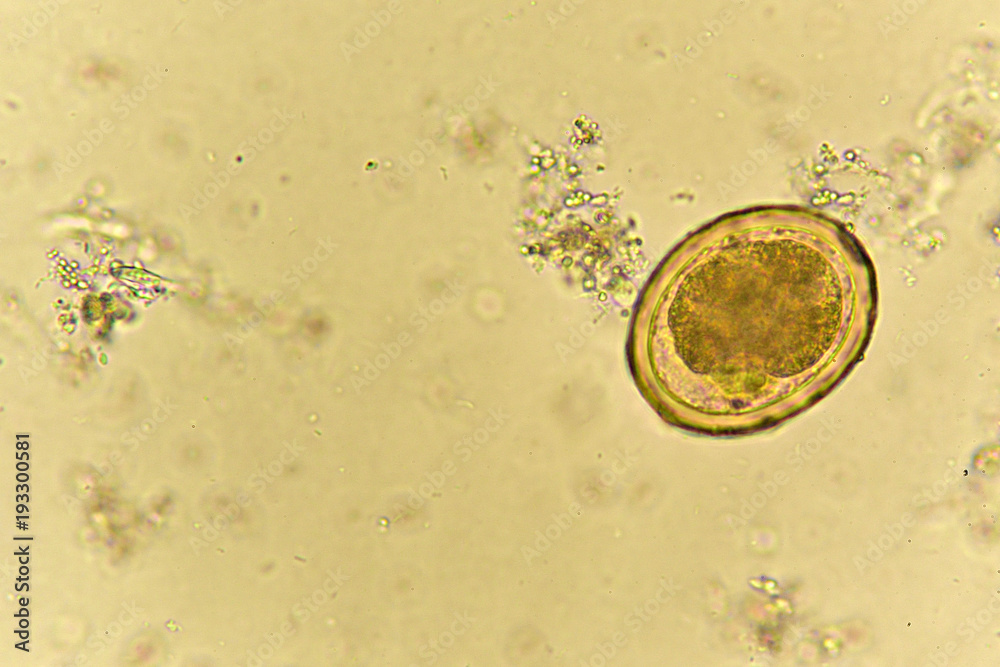 roundworm in stool