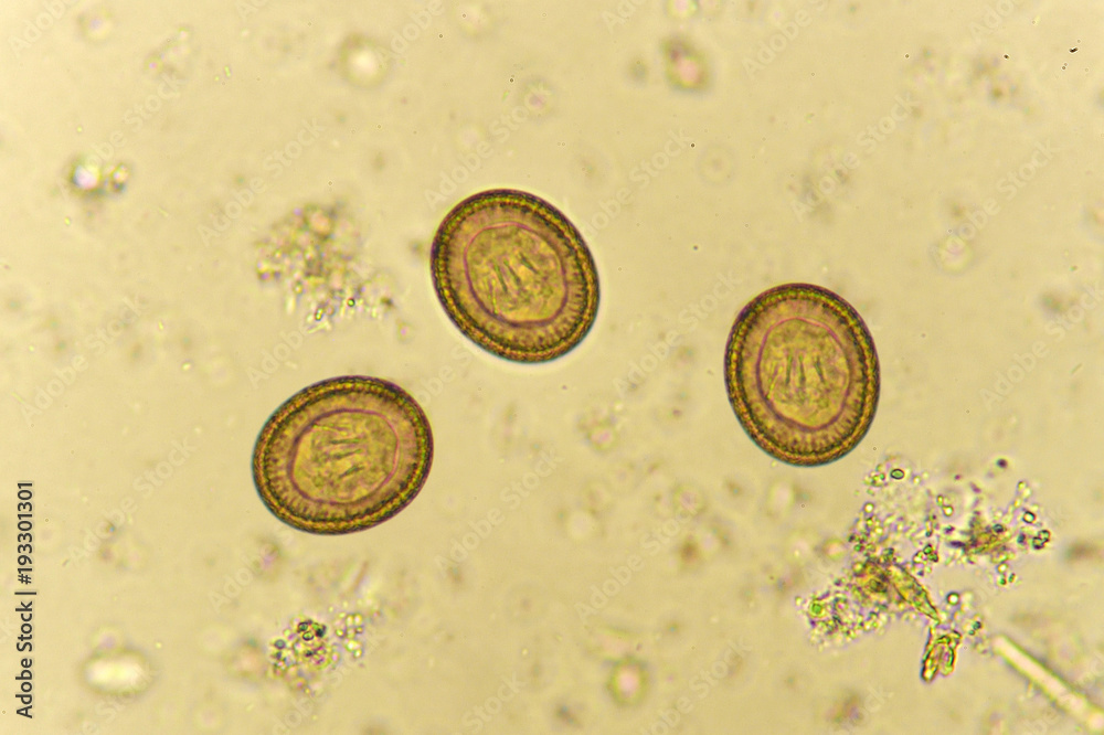 Egg of Taenia in stool, analyze by microscope Stock Photo Adobe Stock Egg of Taenia in stool, analyze by microscope Stock Photo Adobe Stock