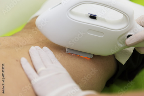 Permanent hair removal at beautician's with laser therapy photo