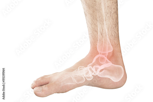 foot bones pain  © TANABOON