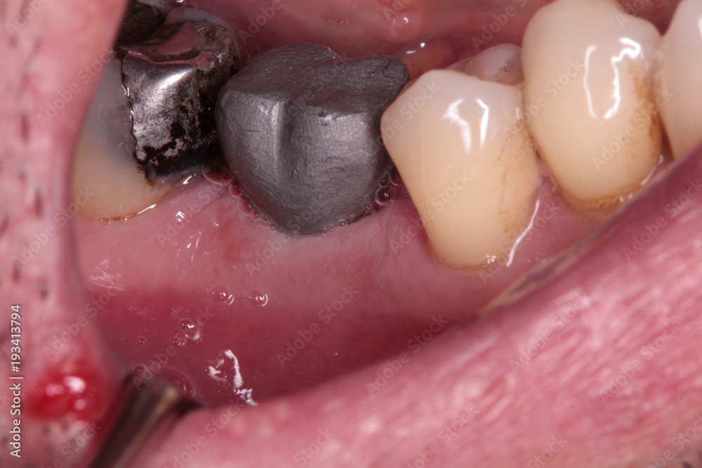 Fototapeta premium dental