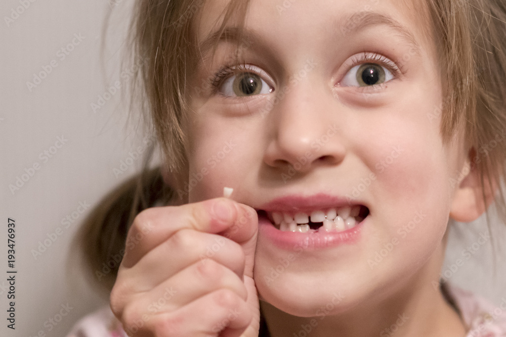 A little girl had a milk tooth. She holds it in her hand A little girl had a milk tooth. She holds it in her hand
