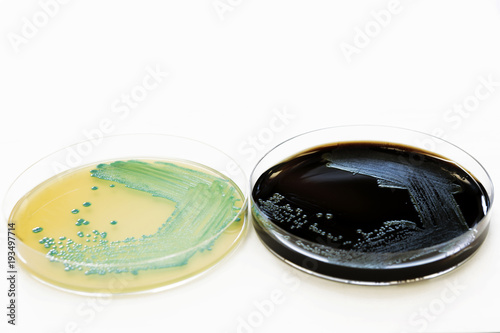 Food safety pathogen Listeria monocytogenes isolated on agar from a food sample.