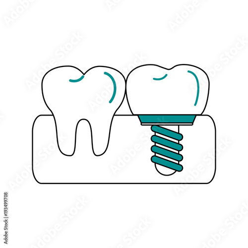 Tooth implant odontology icon vector illustration graphic design