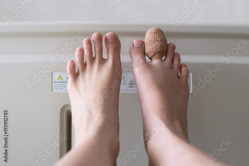 close up of bandage index toe of the female patient sleeping in the patient bed after an accident in the hospital. photo