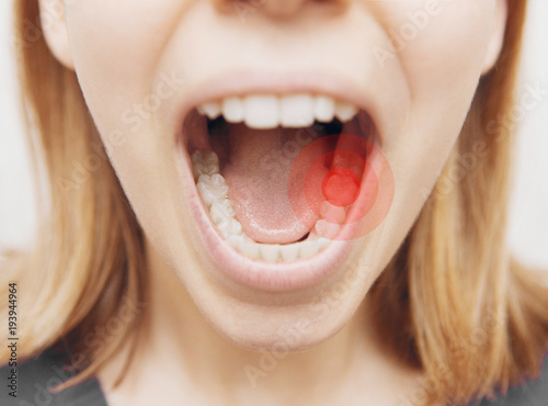 Denti con carie o dolore, bollino rosso