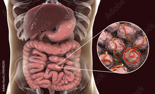 Helminths nematodes Enterobius in the gut. Threadworm which causes enterobiasis, 3D illustration showing close-up view of threadworms located in large intestine photo