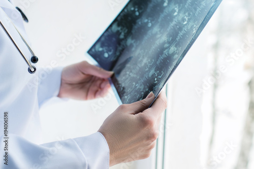 фотографія Magnetic resonance imaging in the doctor's hands.