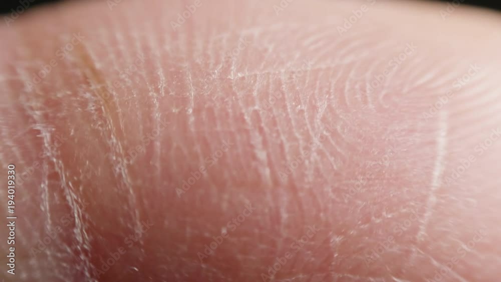 Skin of finger in macro Skin of finger in macro