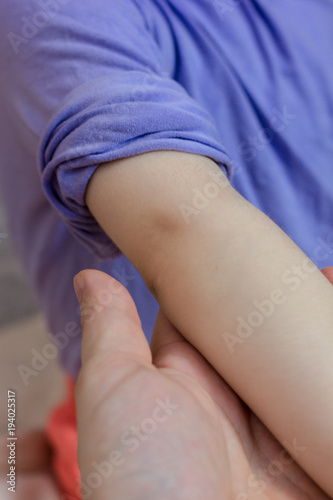 Doctor hand and kid elbow a...