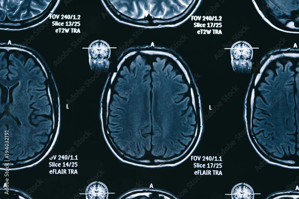 X-ray, MRI brain scan Stock Photo | Adobe Stock
