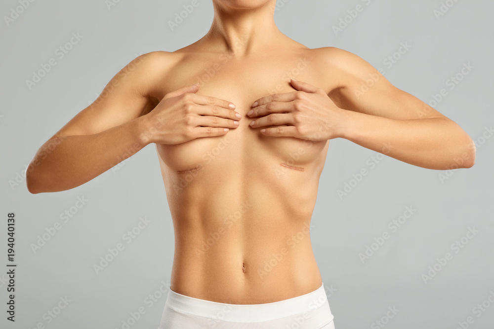 Plastic surgery of the female breast Plastic surgery of the female breast