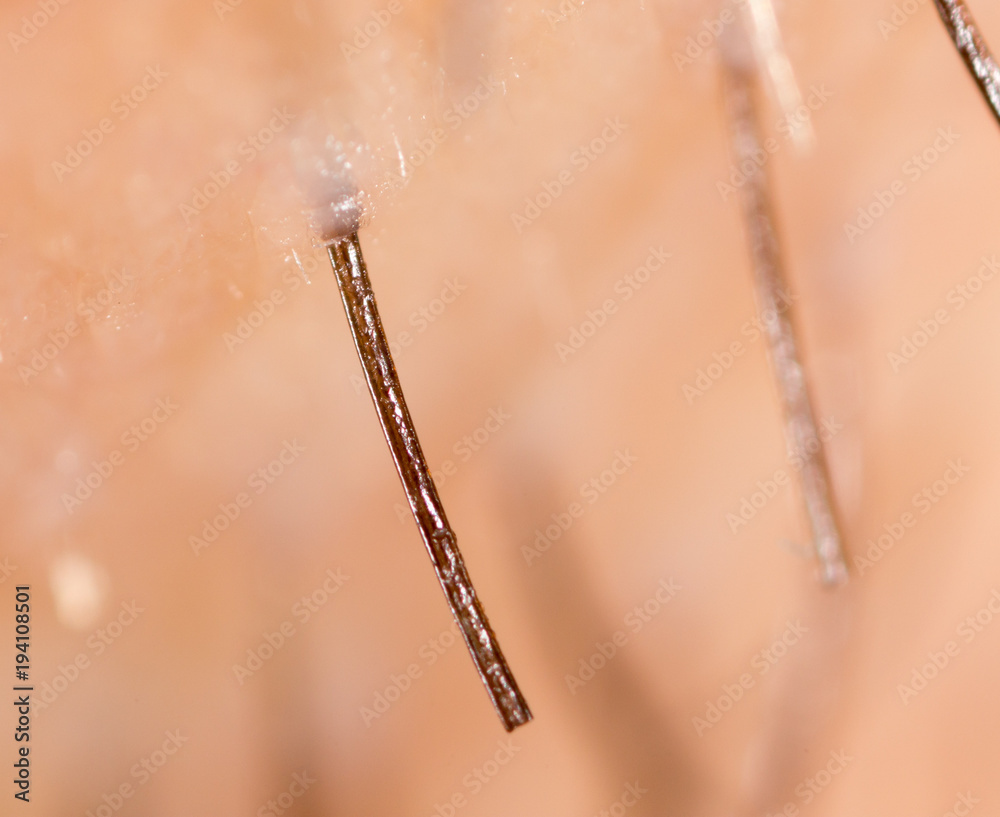 Bristles on the beard of a man Bristles on the beard of a man
