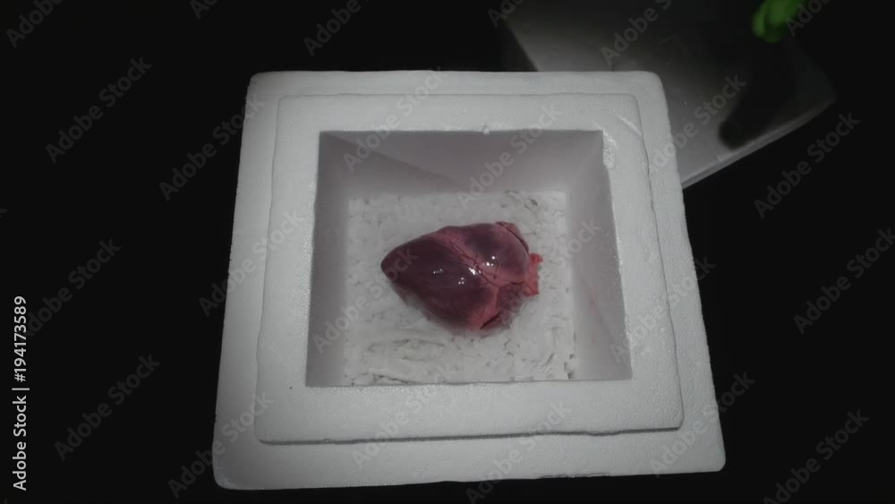 hands in gloves take the heart for transplantation from the container hands in gloves take the heart for transplantation from the container