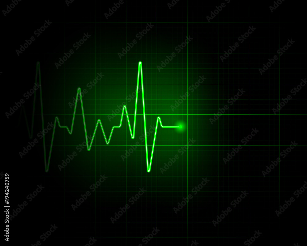 Abstract green pulse backdrop illustration. Medical background Abstract green pulse backdrop illustration. Medical background