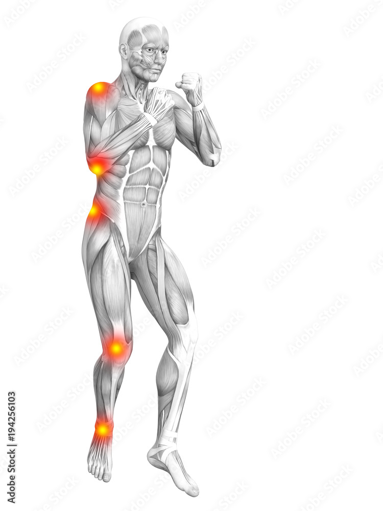 Conceptual human muscle anatomy with red and yellow hot spot inflammation or articular joint pain for health care therapy or sport concepts. 3D illustration man arthritis or bone osteoporosis disease Conceptual human muscle anatomy with red and yellow hot spot inflammation or articular joint pain for health care therapy or sport concepts. 3D illustration man arthritis or bone osteoporosis disease