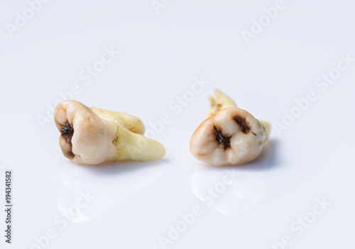 Old torn tooth on a white background
