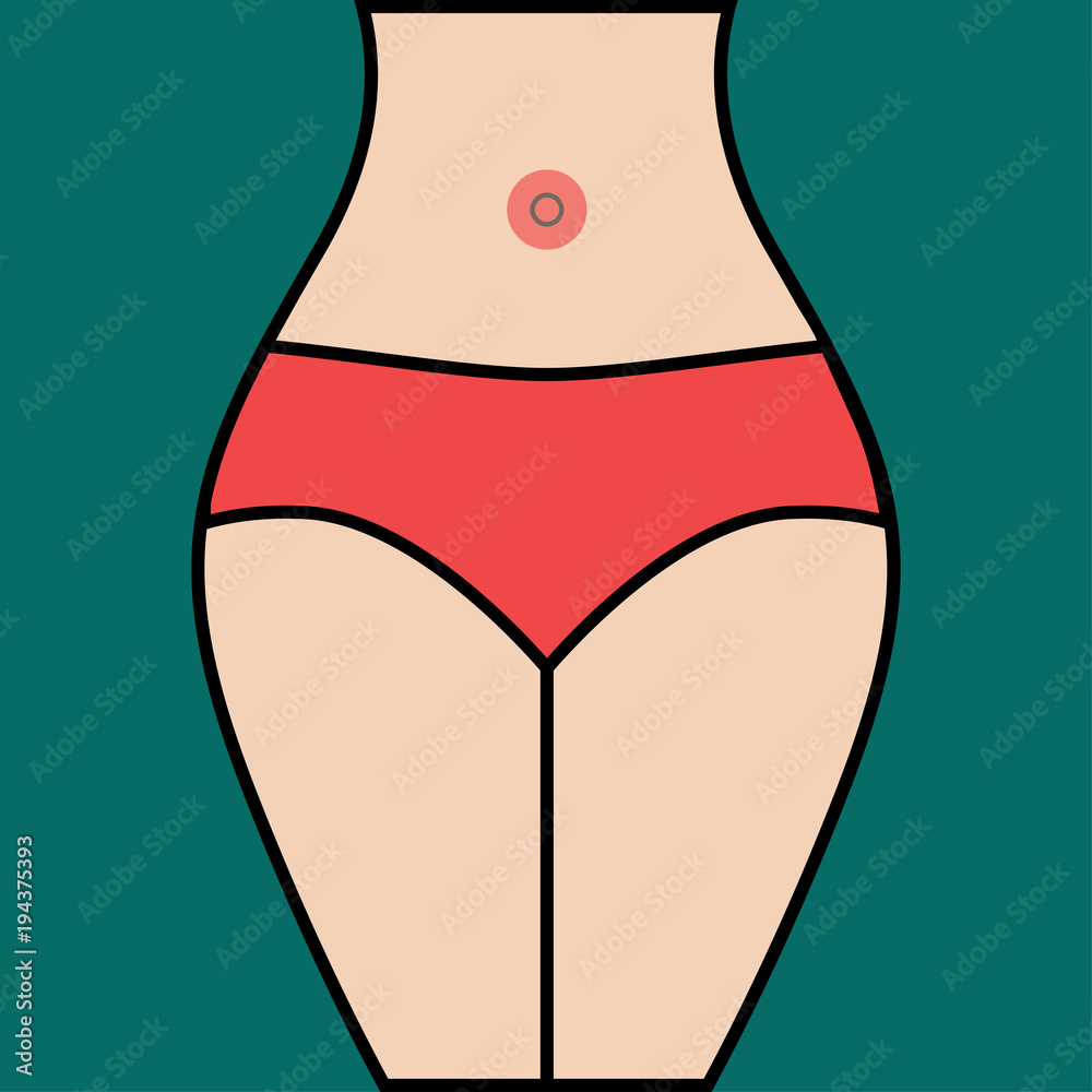 Woman with umbilical hernia Woman with umbilical hernia